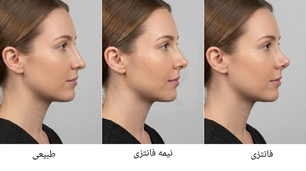 بهترین مدل بینی برای فرم صورت شما؛ بینی طبیعی، نیمه فانتزی یا فانتزی؟