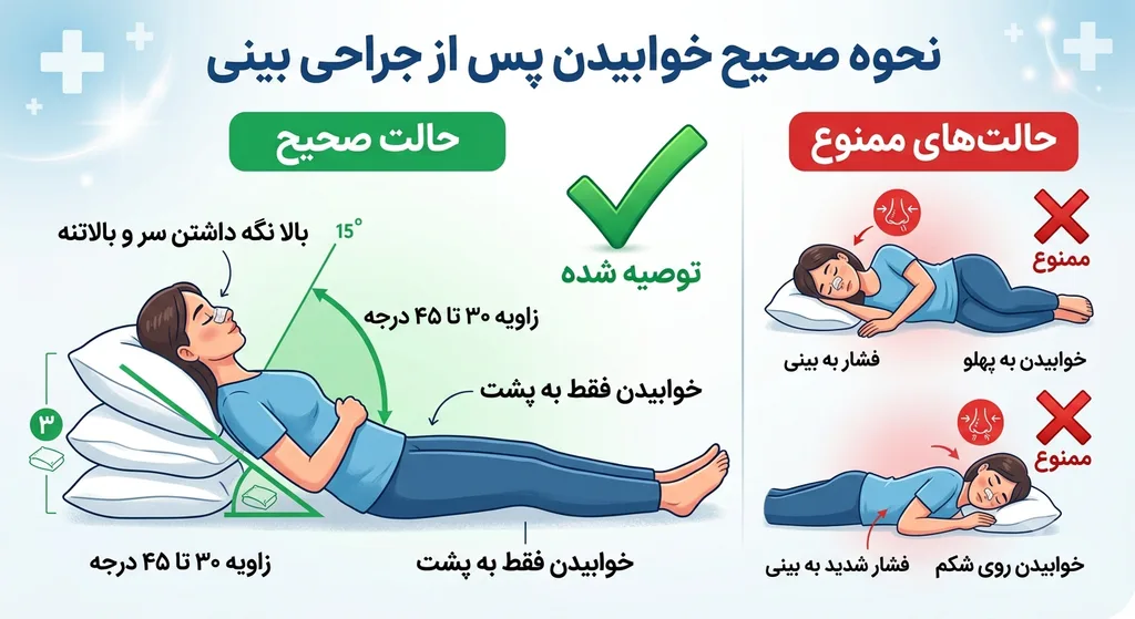 نحوه خوابیدن بعد عمل بینی